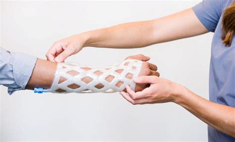 Revolutionary New Arm Cast is Waterproof, Breathable, and Itch-Free