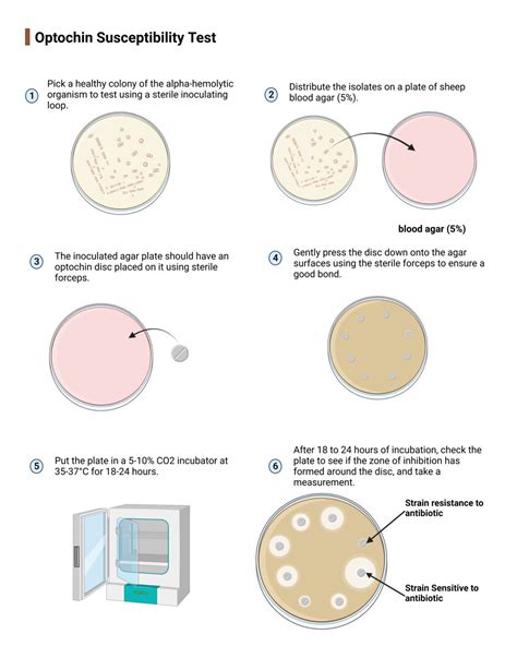 Optochin Susceptibility Test: Principle, Objective, Procedure And ...