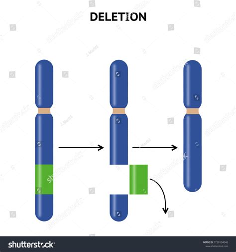 Structural Change Structure Chromosomes Deletion Chromosomal Stock ...