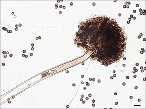 Aspergillus niger