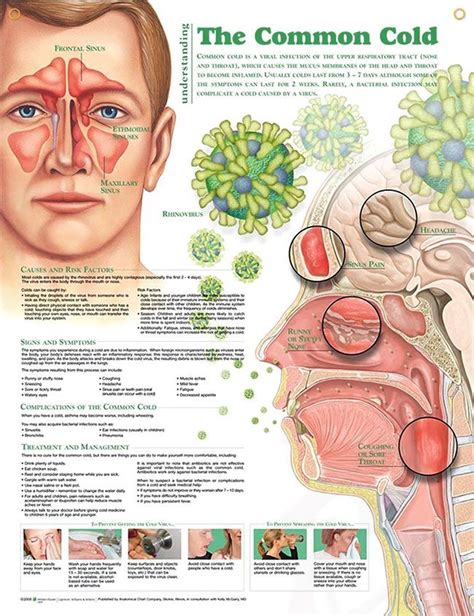 The Common Cold anatomy poster lists causes and risk factors and ...