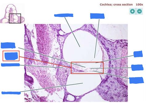 histology of cochlea Diagram | Quizlet