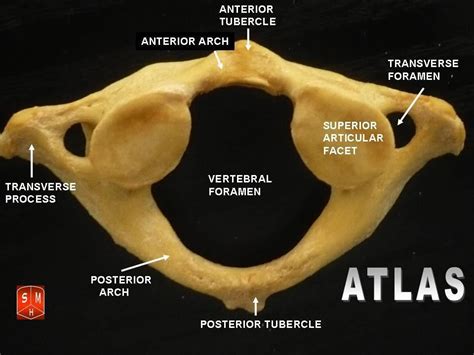 Atlas Vertebrae Labeled