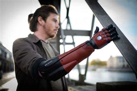 The Hero Arm Overview is a Prosthetic Arm Made by Open Bionics