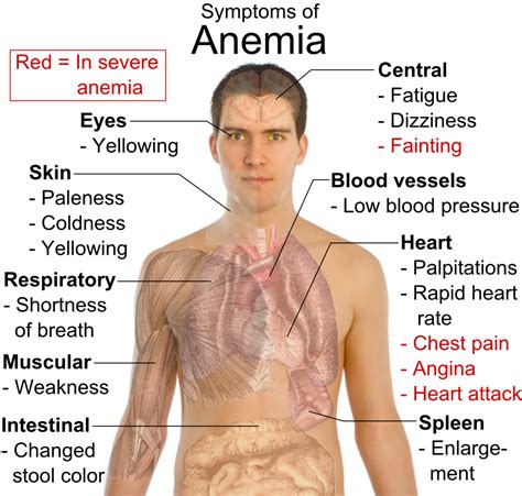 Anemia Symptoms and Causes for Anemia | MedExpress Blog