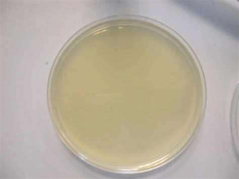 Nutrient Agar : Composition, Preparation and Uses