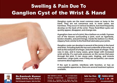 What Helps With Ganglion Cyst Surgery - Margaret Greene Kapsels