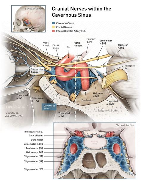 Cranial nerves within the cavernous sinus | AMI 2018 Meeting | Cranial ...