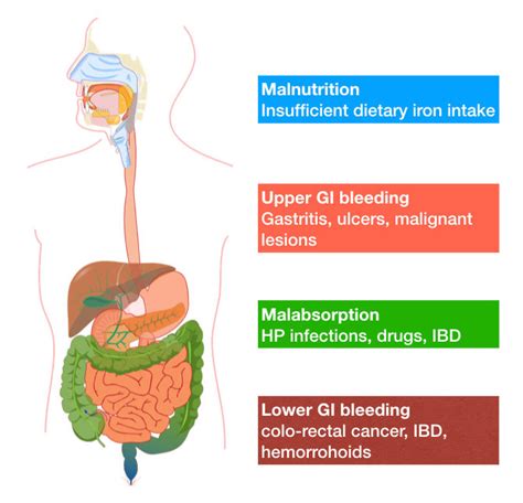 Common causes of IDA in adults include a broader range of potential ...