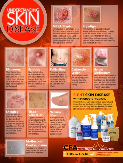 CFA Medical :: Understanding Skin Disease 18'' x 24'' Heavy Poster