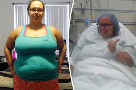 Obese woman loses 9st in one year but is left with 'body of a 90-year ...