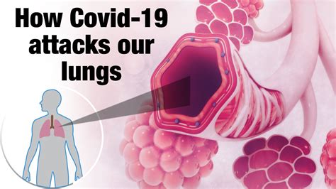 How Covid-19 attacks our lungs - Times of India