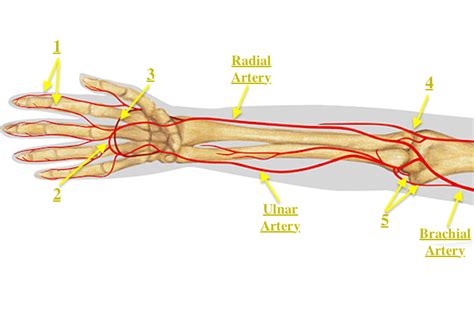 HYPOTHENAR HAMMER SYNDROME (ULNAR ARTERY THROMBOSIS) | Hand Surgery Source