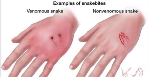 A Definitive Guide To Deadly And Non-deadly Snakes - Ftw Gallery ...