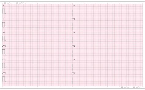 Premium Vector | Blank ECG Paper 12 Lead Electrocardiogram Paper ...