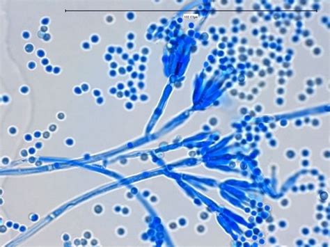 Penicillium ~ Everything You Need to Know with Photos | Videos