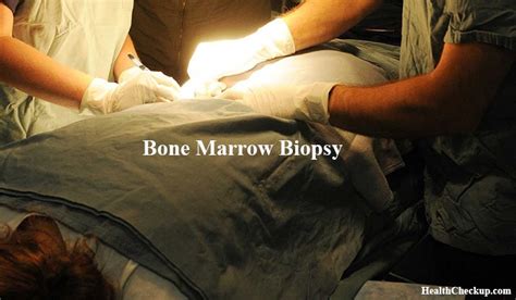 Bone Marrow Biopsy Test Procedure & Results| Health Checkup