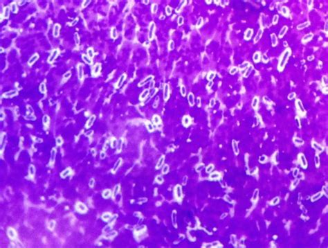 Streptococcus Capsule Stain