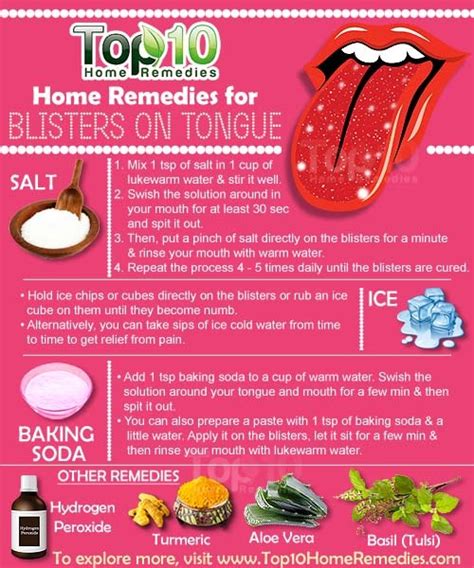 Home Remedies for Blisters on Tongue | Top 10 Home Remedies