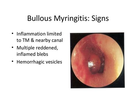 Infections of the external ear