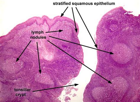 Pharyngeal Tonsils Histology Labeled