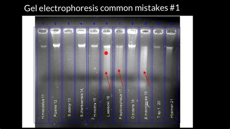 How To Read Gel Electrophoresis