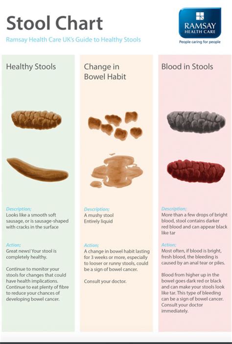 Bowel cancer symptoms: Black stool could be a sign - what a healthy poo ...