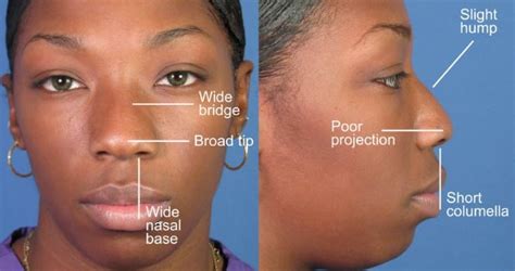 Nose Types - Personality, Ethnicity and Ancestry