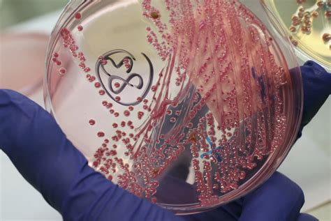 Number of People in Latest E. Coli Outbreak Expected to Grow