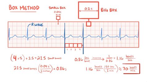 ECG rate and rhythm: Video, Anatomy & Definition | Osmosis