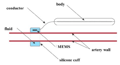 MEMS-device design. Option 1 | Download Scientific Diagram