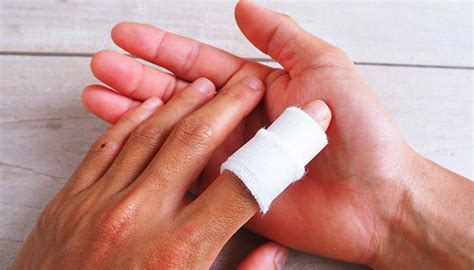 Your Finger Injury Guide: What They Are and How to Treat Them