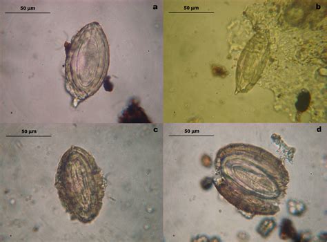 SciELO - Brasil - First record of Acanthocephala parasites eggs in ...