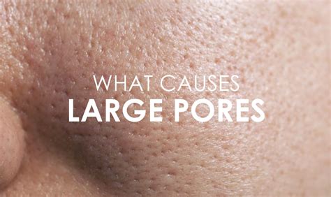 31+ Breast Hair Follicles Large Pores - HarleyMengjie