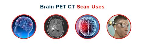 Brain PET CT Scan | Its Uses, Procedure and Risks