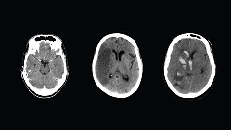 How To Read Ct Scan