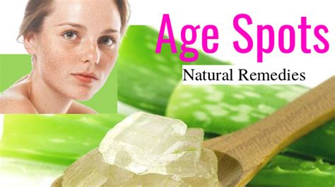 4 Natural home remedies for age spots on face | That work wonders