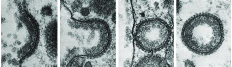 1: Electron microscopy images of clathrin endocytosis. The radius of a ...