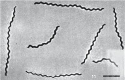 Spirochaeta - microbewiki