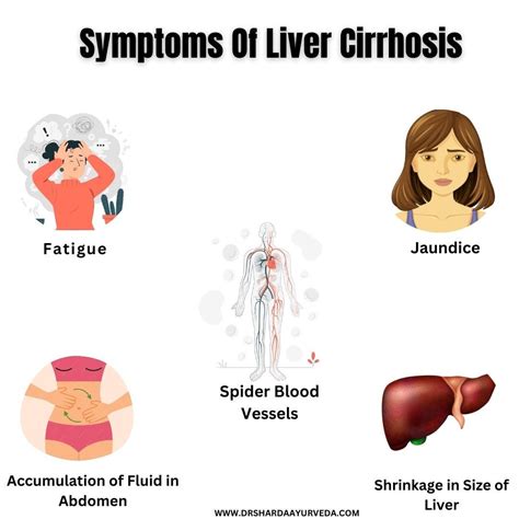 Benefit of Ayurvedic herbs in the treatment of Liver Cirrhosis | by ...