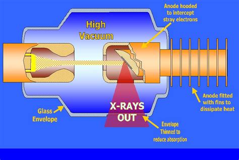 X Ray Tube Diagram Explained