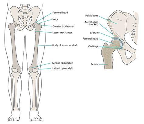 Femoral Osteotomy: Anteversion, Retroversion, Surgery | HSS