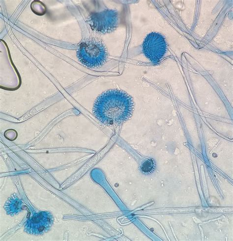 Aspergillus flavus conidial heads at various stages of development ...