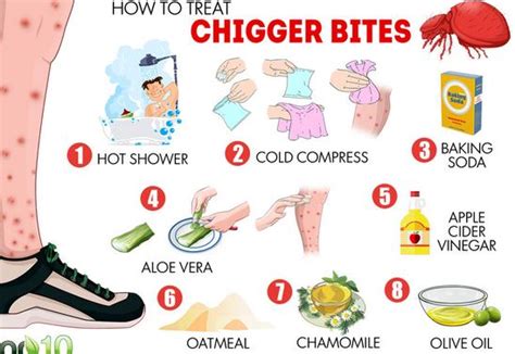 Chigger Bites - Pictures, Treatment, Look Like, Home Remedies