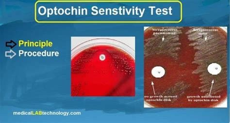 Optochin sensitivity test: Principle, procedure | Principles, Test ...