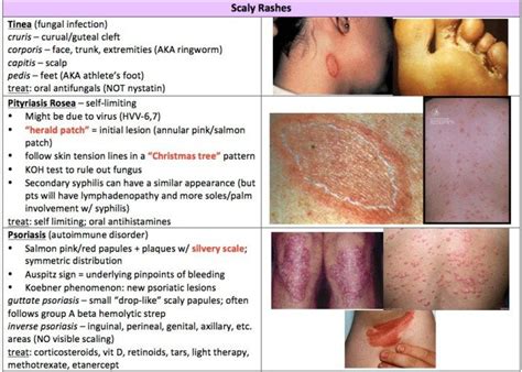 Pin on Dermato-Venereology - ist