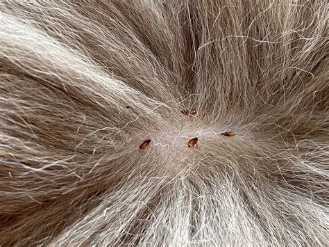 How To Get Rid Of Fleas Off Human Hair at Philip Woodard blog