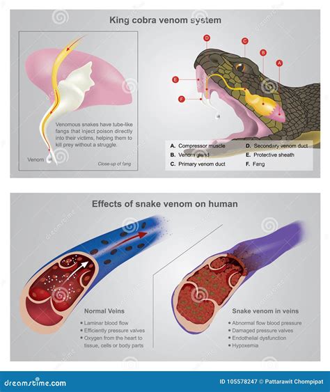 Effect of Snake Venom on Human. Info Graphic Illustration. Stock Vector ...