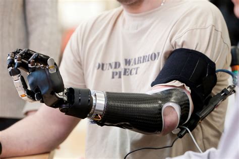 Robotic Prosthetics – Technology for the Future is Now - GizHub