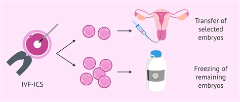 Cryopreservation of remaining embryos